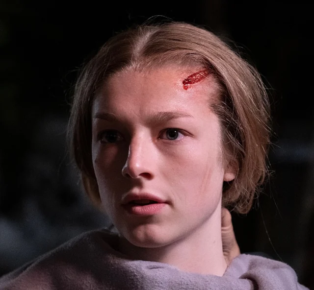❗️Prosthetic Make-up❗️
•
„Cuckoo“ 2022
Currently playing in theaters!
•
@cuckoomovie 
@neonrated 
@fiction_park 
•
Some more shots, including a short video of stapling the intense forehead wound we created on lovely @hunterschafer .
We designed a silicone prosthetic, that covered a part of the forehead and went further into the hairline. 
A thin skin protector underneath allowed to show the stapling on camera.
The transition and blood tubing was covered by neatly punched and styled hair. 
•
Make up effects design by 
@twilightcreations 
Tamar Aviv & Jörn Seifert
Sculpted by @lazerliz_arts 
Mold making and Silicone running by 
Kerstin Buss and @lalax_ro 
Prepainted by @julietteruetz 
Hair punching by
@julianhutcheson @judithgerdsmeier 
On set prosthetic supervisor, application and blood fx by Tamar Aviv.
Thank you to Make-up and Hair designers @astrid_weber77 and @hannahfischleder for involving us and your support.
Still photographers on set 
@felix.aaa 
@mmonicalek
•
Thanks to our entire crew for their hard work to get these effects done and look so well ! 🙏🏼
• 
@weltkinofilmverleih 
@hessenfilmundmedien
@filmedienrw 
•
@thatdanstevens 
•
#cuckoomovie #prosthetics #silicone #headwound #stitched #realisticart  #painting🎨 #woundcare #mouldmaking #sculpting #hyperrealism #hunterschafermakeup #hunterschaferedit #bleeding #twilightcreations #scarred #setlife🎬 #horrormoviescene 
#specialmakeupeffects #specialeffectmakeup #fxmakeupartist #sfxwounds #sfxgore #fxmakeupart #sfxmua #makeupfx #specialmakeupfx #specialmakeup 
@hunterschaferhi 
@hunterschafer1